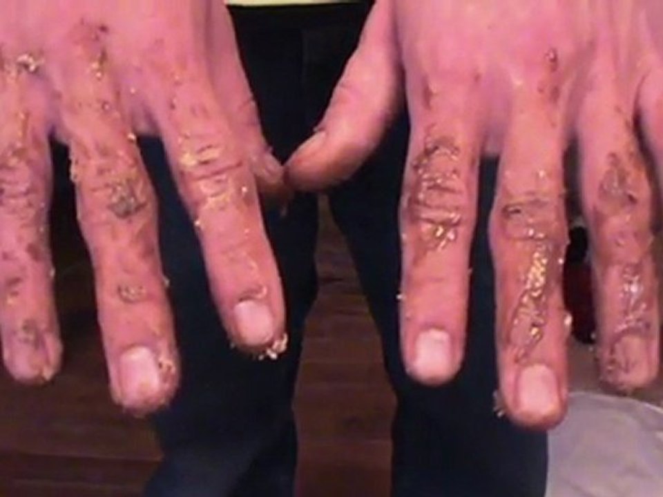 Shit Fingers?!