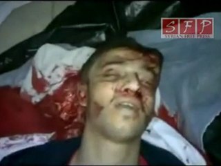 18+ | الشهيد ياسر استانبولي جبلة 5-6-2011