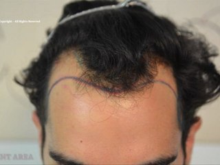 FUE 3100 UFs Dr Lupanzula (MeDiKemos)-ENG