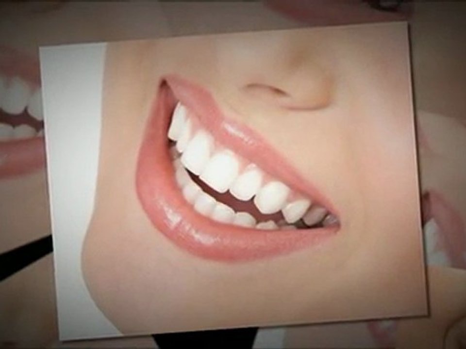 Teeth Whitening Halifax NS-CA