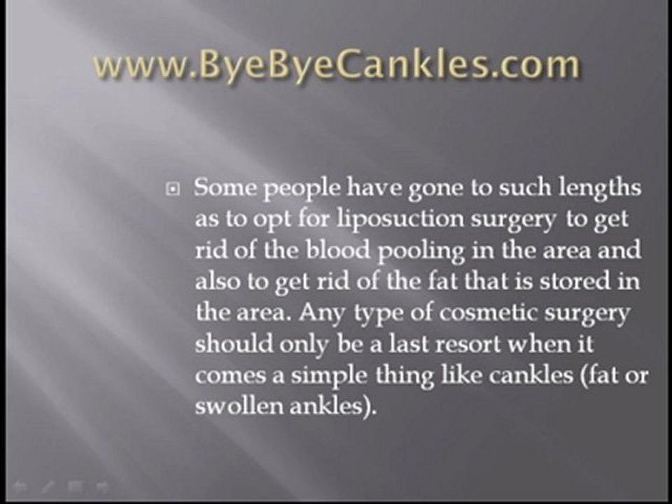 Cankles Definition - What Are Cankles and How Can You Get Rid of Them
