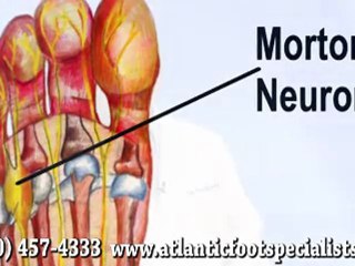 Neuroma - Podiatrist in Southport and Shallotte, NC