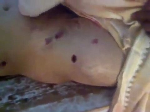 فري برس 18+ حمص ديربعلبة جثمان الشهيد زياد المصري الفيديو فظيع 28 11 2011