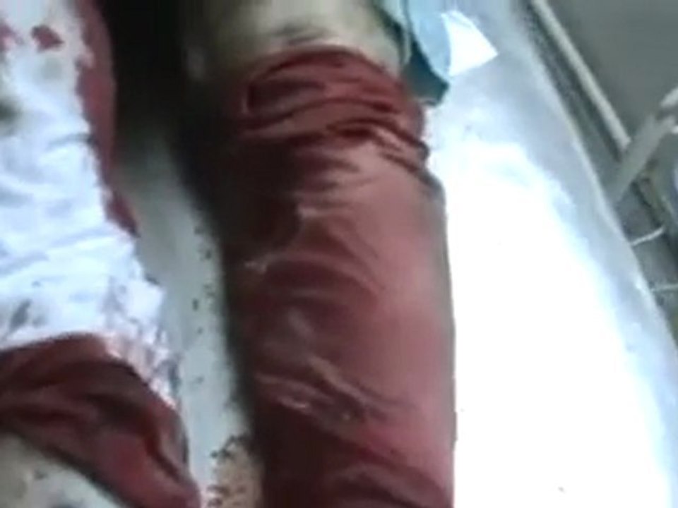 فري برس   الشهيد شماع شهير شماع يلفظ انفاسه الأخيرة 24 1 2012