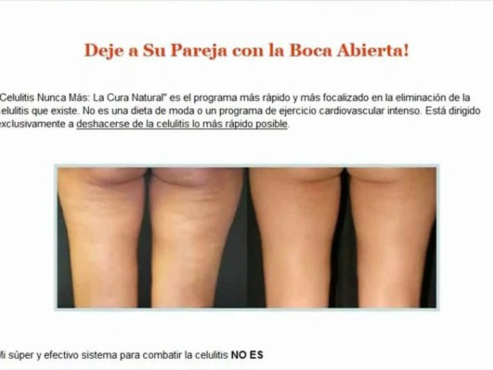 Tratamiento Natural para la Celulitis - Celulitis Nunca Más