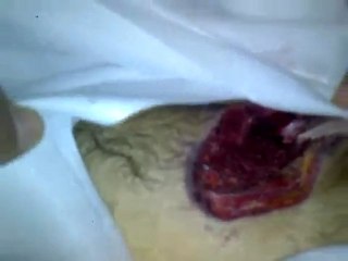 فري برس   حمص الحولة   الشهيد مؤيد محمد نور القاسم 17 12 2011