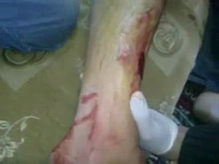 فري برس   ريف دمشق   زملكا  جمعة بروتوكول الموت 23 12 2011 ج2