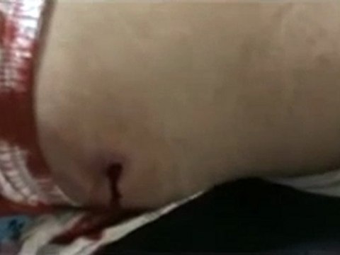 فري برس حمص وادي العرب إصابة أحد المواطنين برصاص القناص 3 1 2012