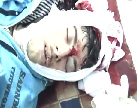 فري برس حمص كرم الزيتون الشهيد خالد زياد ستيت يلفظ انفاسه +18