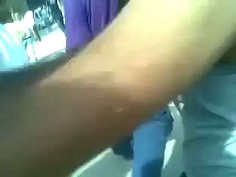 فري برس القامشلي أحد المصابين أثناء تشييع الشهيد مشعل تمو 8 10 2011