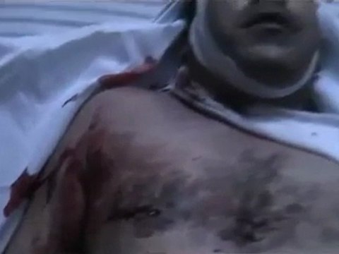 فري برس الشهيد محمد علي العيسى 14 10 2011