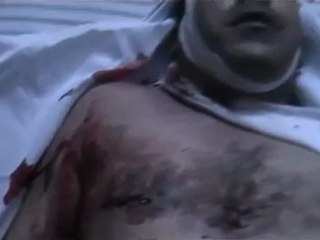 فري برس   الشهيد محمد علي العيسى 14 10 2011