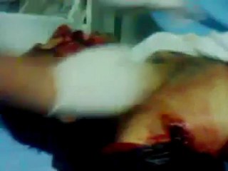 فري برس   حمص محاولة اسعاف الشهيد ايمن حبوس 24 10 2011