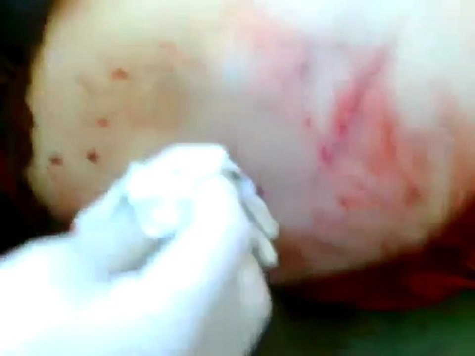 فري برس   طفلة من باباعمرو شهيدة القصف على الحي 7 11 2011