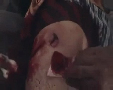 فري برس حمص كرم الزيتون اصابة شاب بل فخد الايسر 10 10 2011