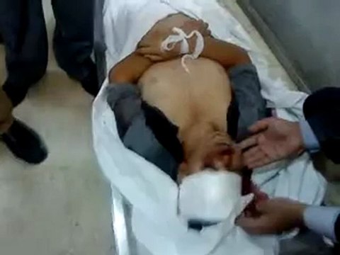 فري برس الشهيد ياسين المسالمة في ثلاجة المستشفى الوطني بدرعا