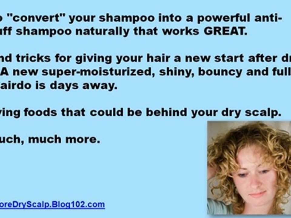 remedies for dry scalp - home remedy for dry scalp - dry itchy scalp remedies