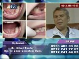 DR.NİHAT TANFER ATV AVRUPA 05.06.2010