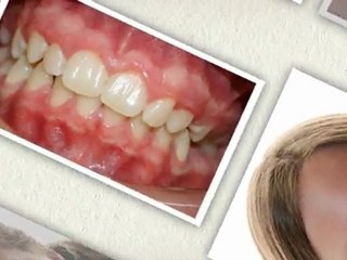 Orthodontists Greeley Jan2012