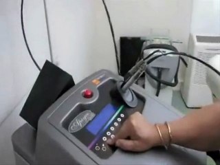 EPILATION LASER JAMBE