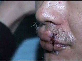 Prisoners in Kyrgyzstan sew mouths shut in hunger strike