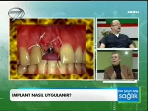 DR.NİHAT TANFER KANAL7 HERSEYIN BASI SAGLIK 21_01_2012