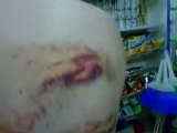 فري برس   حوران صيدا تعذيب احد المعتقلين من صيدا في اللواء 38 لمدة 3 ايام بتاريخ  30 1 2012