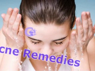 Effective Remedies for Acne 🌟