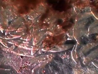 Parameciums caudatums murmures