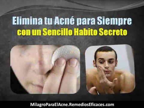Como Eliminar el Acne en 7 Dias - Como Eliminar las Marcas del Acne