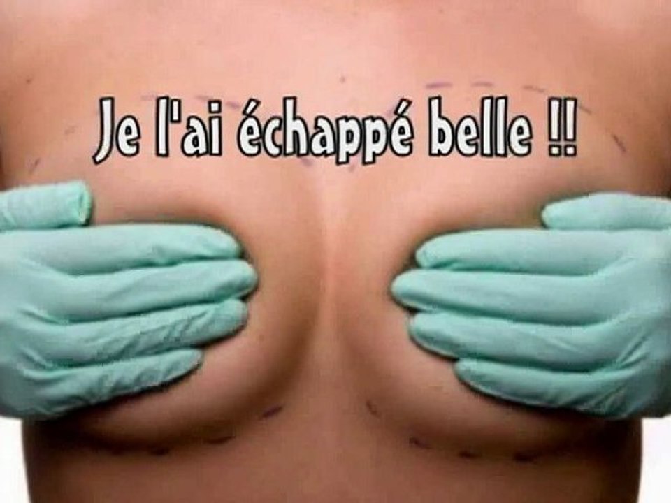 "Prothèse" - Le scandale !
