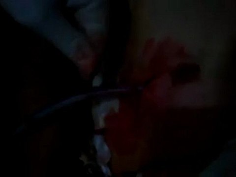 فري برس حمص الرستن جرحى المدينة الله عافيهم 31 1 2012