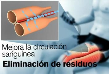 Compex Runner Electroestimulador