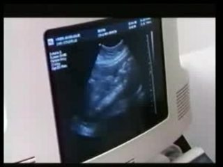 Striptease - Tiens ta droite II