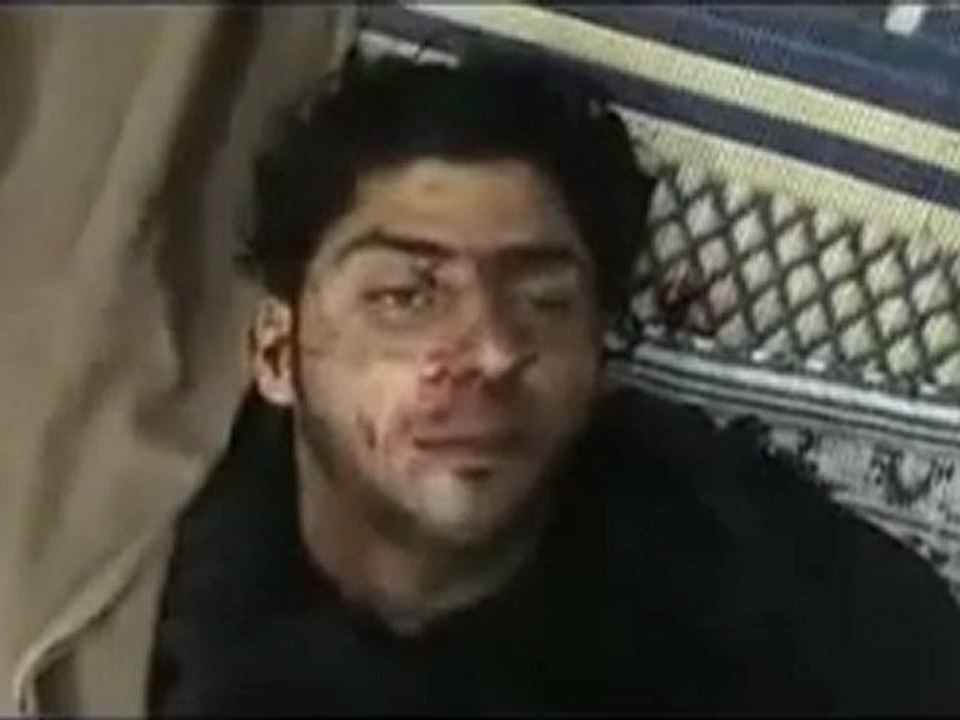 فري برس   حمص الخالديه الجرحى جراء قصف عصابات الاسد  +18؛؛؛مجزرة 4 2 2012 جــ2