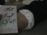 فري برس   حمص حي الرفاعي أصابة خطيرة بالخاصرة جريمته التكبير 5 2 2012