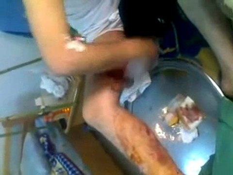 فري برس ريف دمشق داريا إصابة أحد المدنيين بطلق ناري 6 2 2012