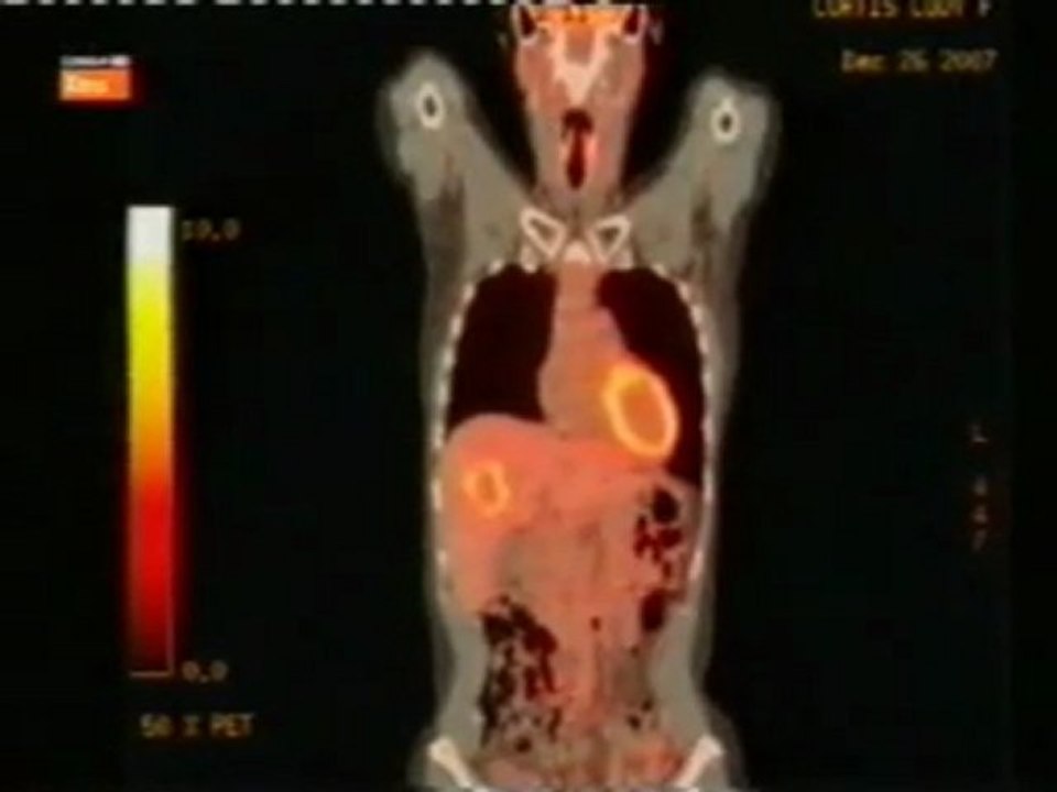 Eutanasia: Cancer hepatico (Codie)