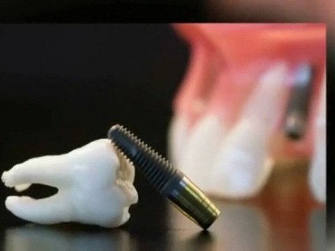 Best Dental Implants Lincolnwood - Cosmetic Dentistry Servic