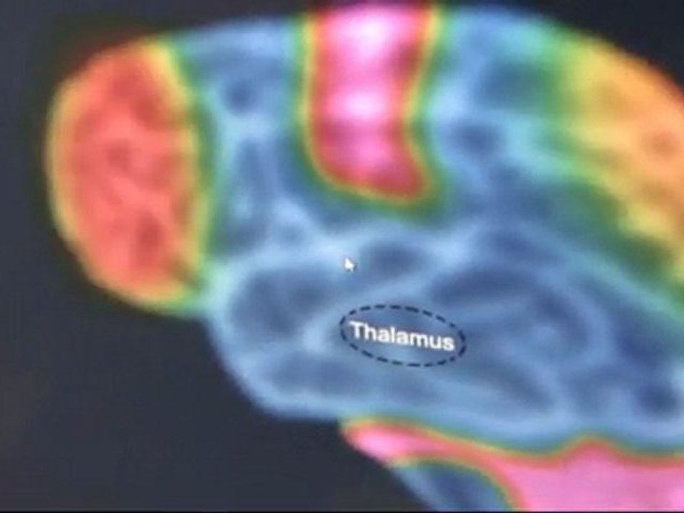 OCZ NIA Neural Impulse Actuator Plus Brain Mouse Demonstration Pong Linus Tech Tips