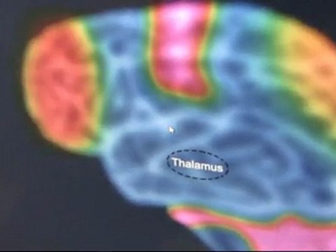 OCZ NIA Neural Impulse Actuator Plus Brain Mouse Demonstration Pong Linus Tech Tips