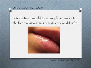 como se cura el herpes labial