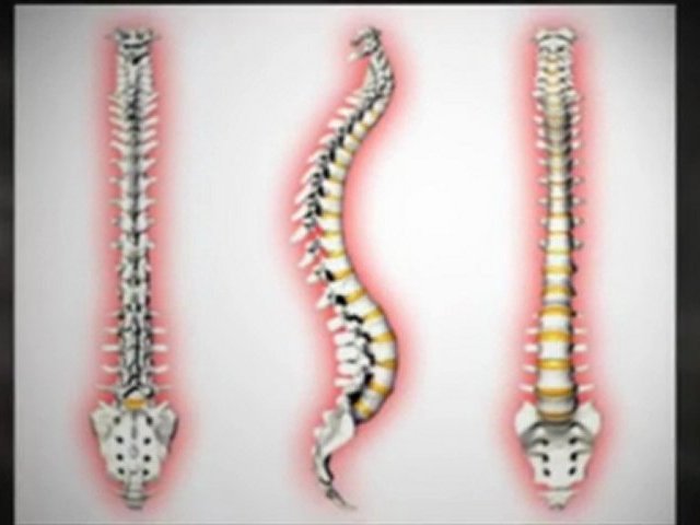 Chronic Back Pain Relief with The Back Bubble