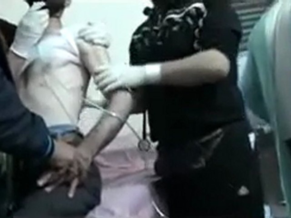 فري برس   حمص باباعمرو أحد المصابين يختنق جراء إصابة الرئة من الظهر