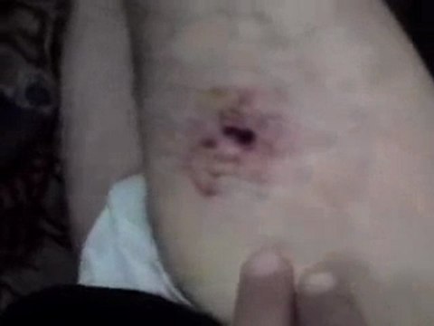 فري برس دمشق المزة جمعة النفير العام إصابة أحد الأحرار 10 2 2012