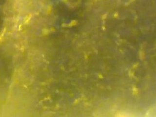 Un des plus petits coeurs au monde 75 microns