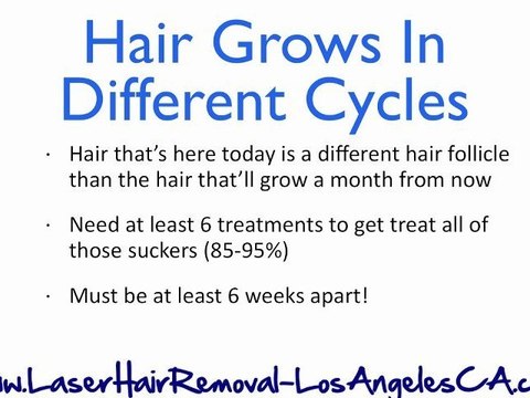 Best Laser Hair Removal Los Angeles - Laser Hair Removal LA
