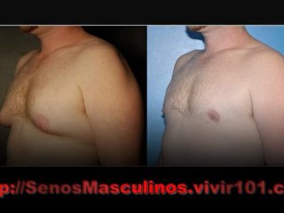 Perder Grasa En El Pecho - Reducir La Grasa Pectoral - Ginecomastia En Hombres