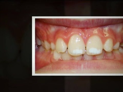 Orthodontists Dallas Jan2012