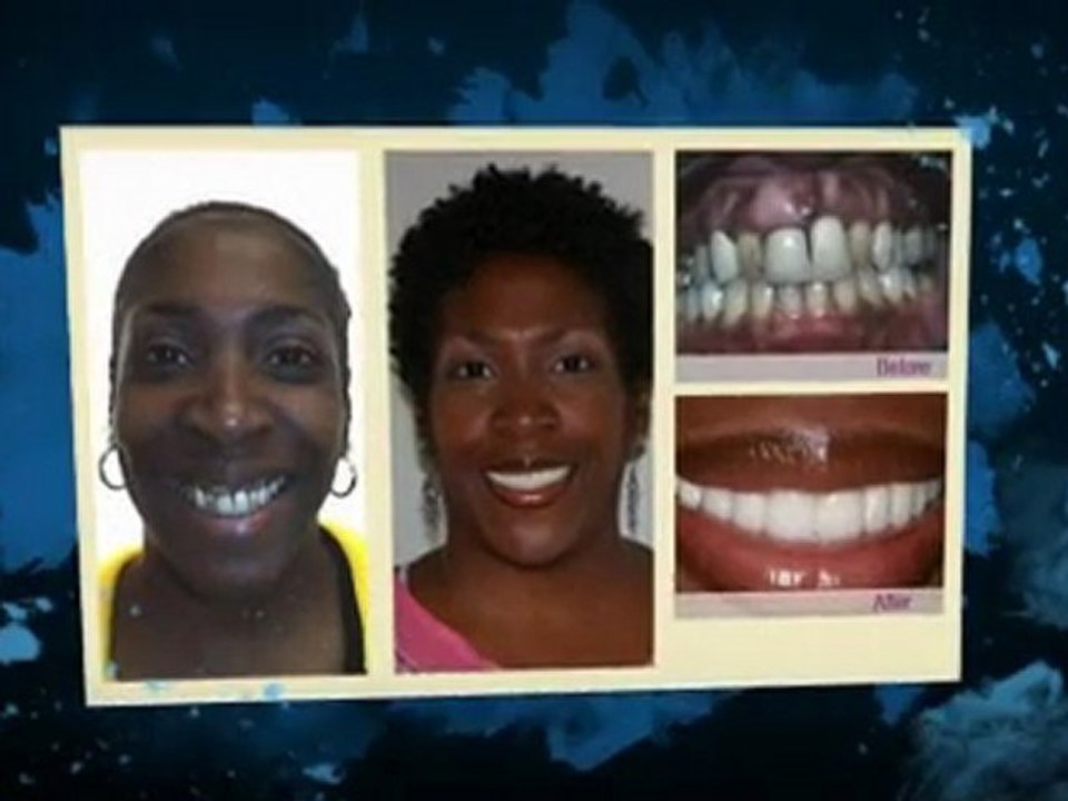 Dentist Philadelphia